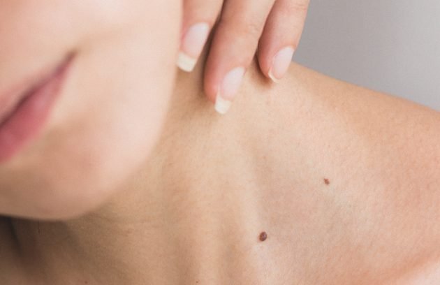 Hands on neck